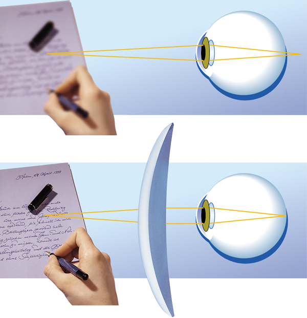 opticalbasics optics eye ametropic eye presbyopic with | Bio Rama DOBROBITI RUPIČASTIH NAOČALA