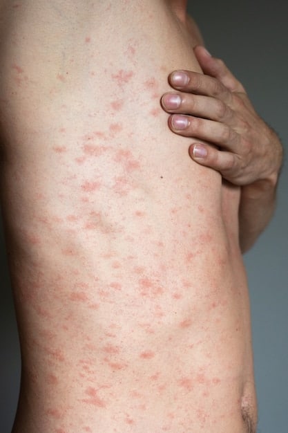 allergy concept man suffers from skin irritation isolated gray background itchy back with rash 96872 5582 | Bio-Rama Kako se na prirodan način zaštiti od komaraca (Recepti)