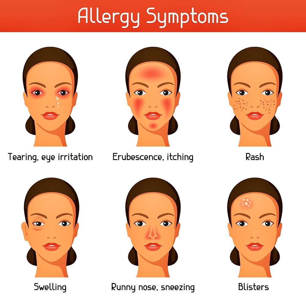 allergy symptoms | Bio-Rama Alergija na pelud! uzroci, simptomi i liječenje!